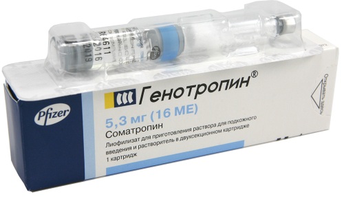 Синдром Шерешевского-Тернера. Кариотип, что это такое, причины, лечение, диагностика